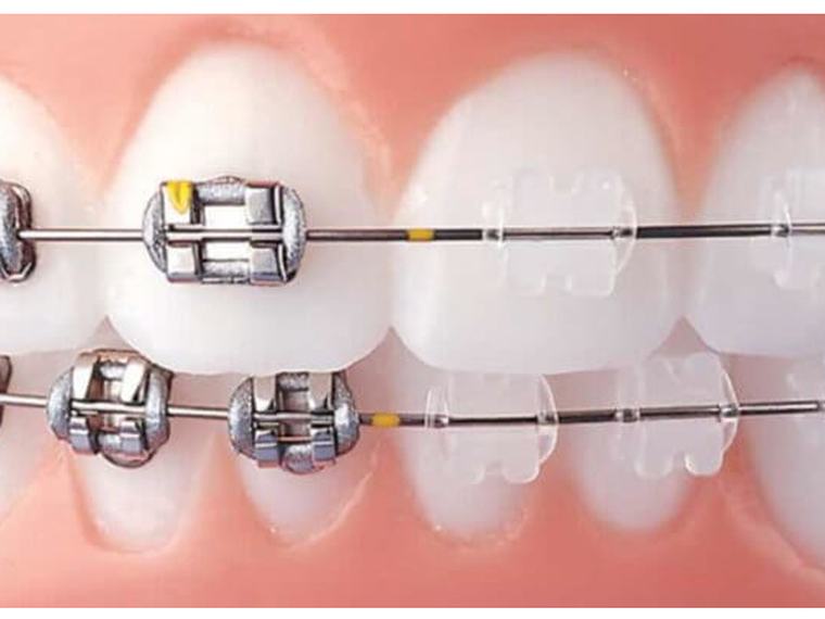 Clínica Dental Crissdent