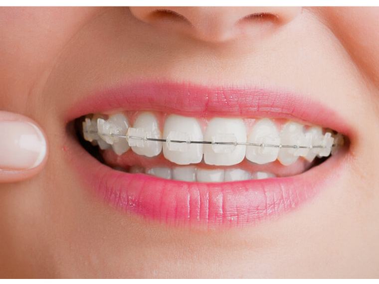 Clínica Dental Crissdent