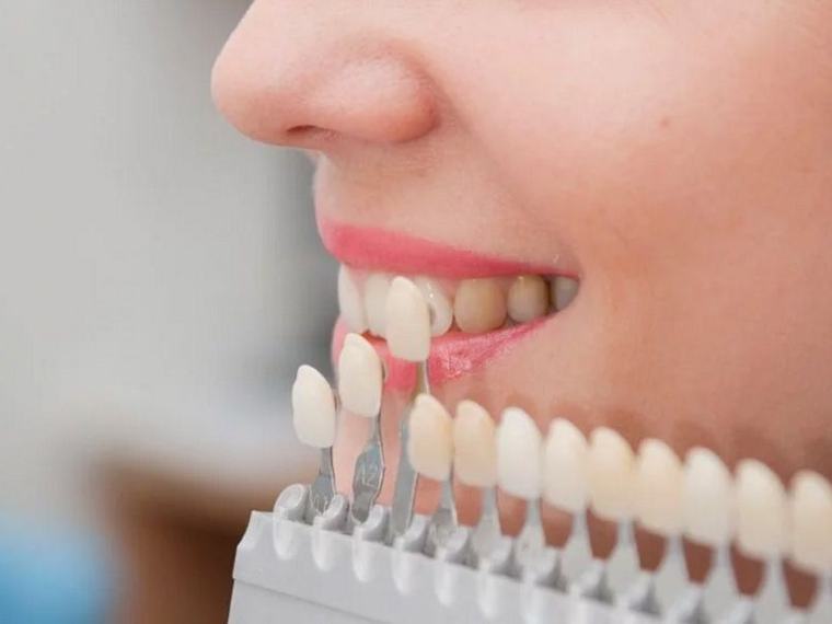 Clínica Dental Crissdent