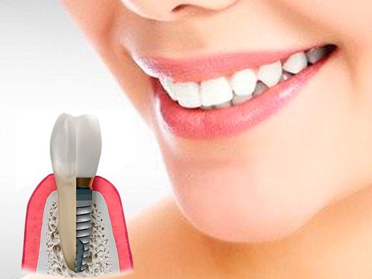 Clínica Dental Crissdent
